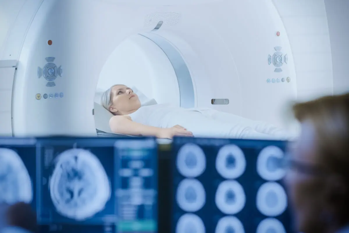 Radioterapia cerebral.