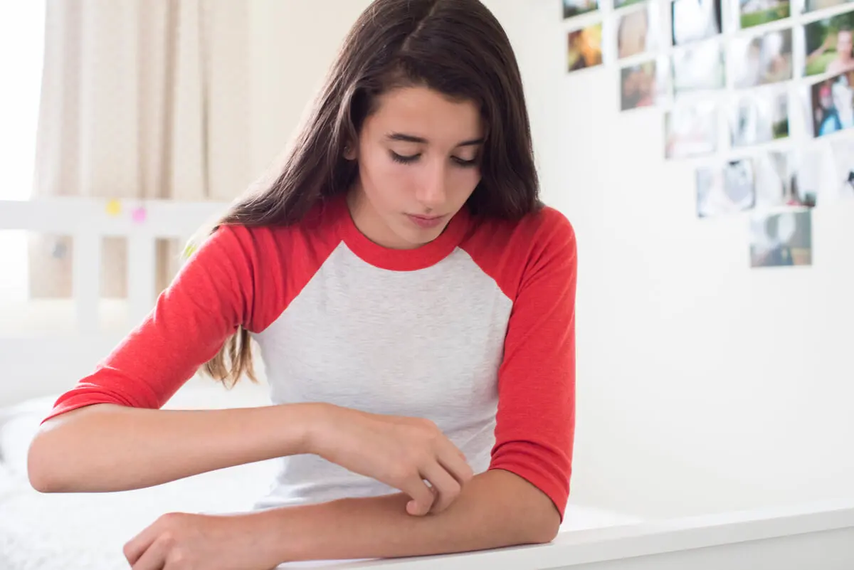 Picazón de piel en mujer adolescente.