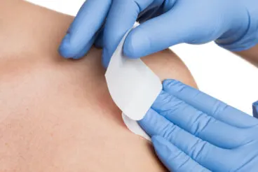 ¿Qué es la biopsia de piel?