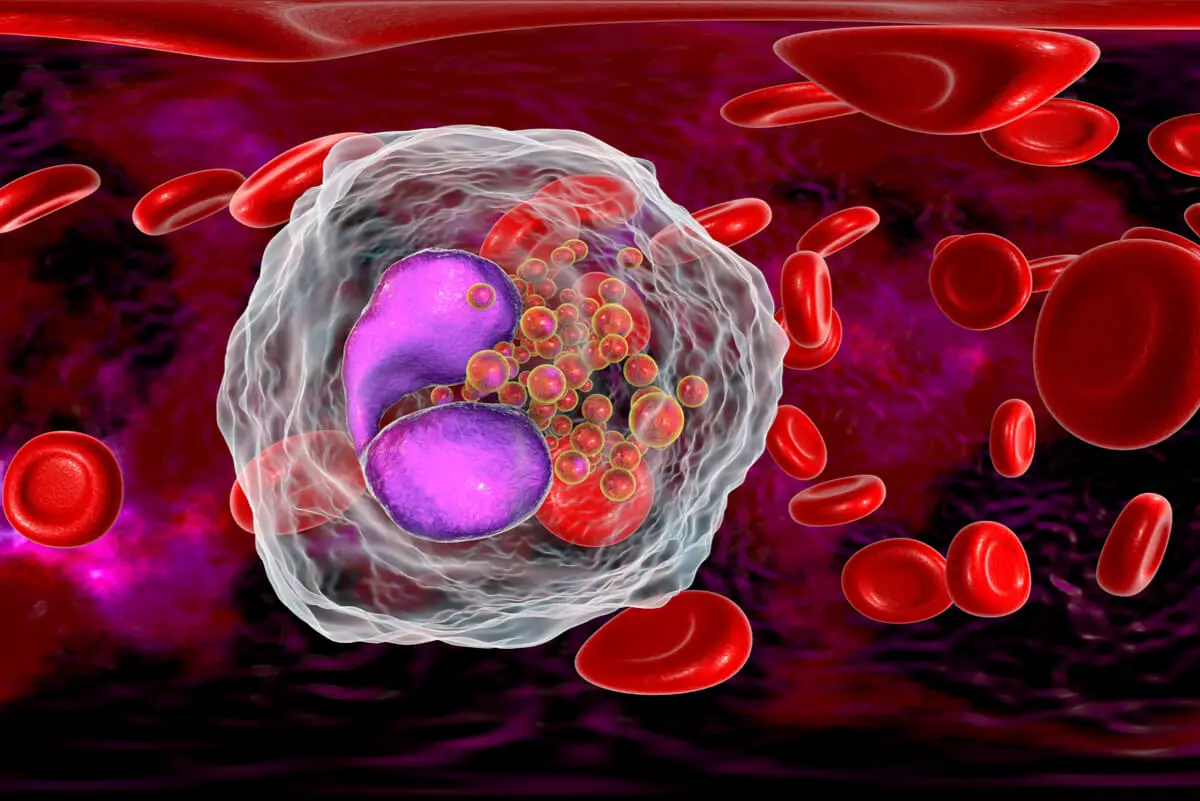 Chronische eosinofiele leukemie