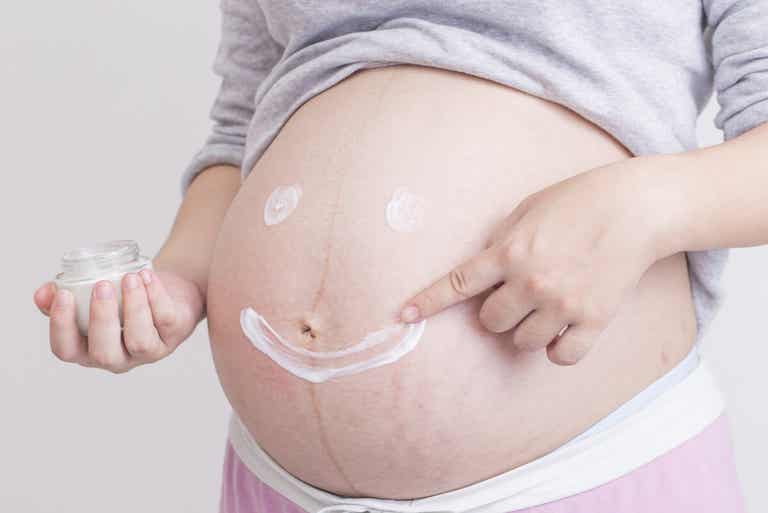 Estrias de gravidez.