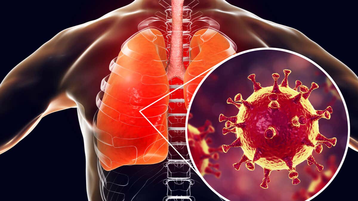 ¿Es la bronquitis contagiosa? - Mejor con Salud