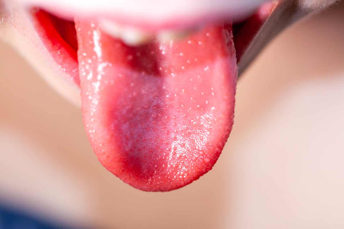 Deine Zunge gibt Auskunft über deinen Gesundheitszustand