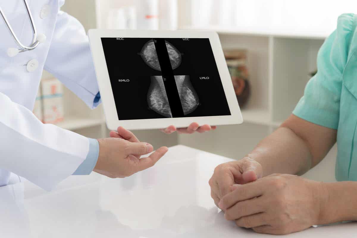 Médico muestra y explica mamografía.