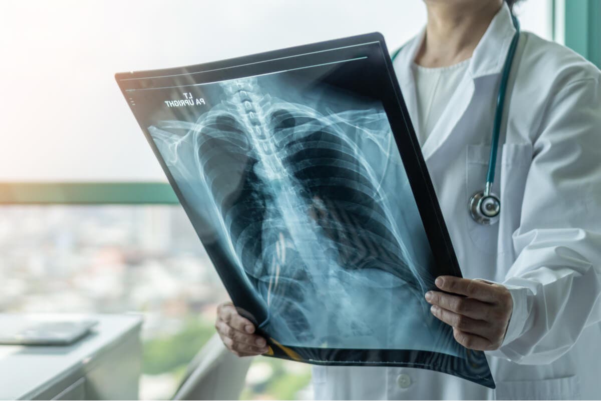 Médica revisa radiografía y encuentra cardiomegalia.