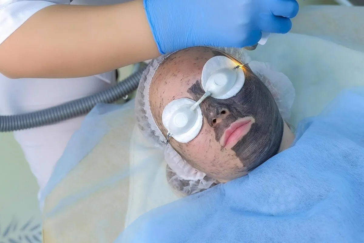 peeling facial