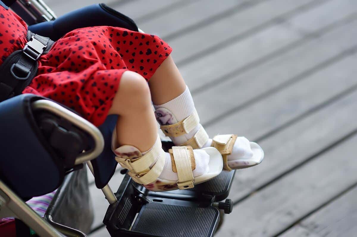 Physiotherapie bei Zerebralparese - Mädchen im Rollstuhl