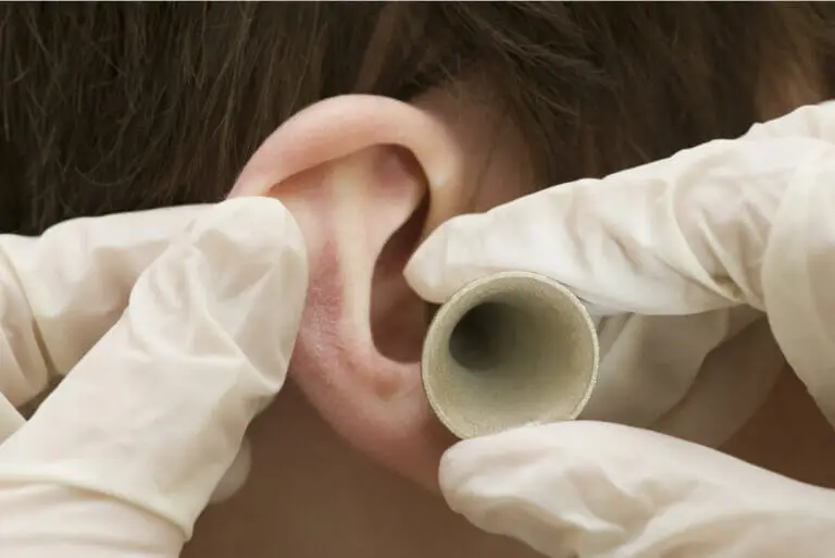 Mastoiditis: síntomas, causas y tratamiento
