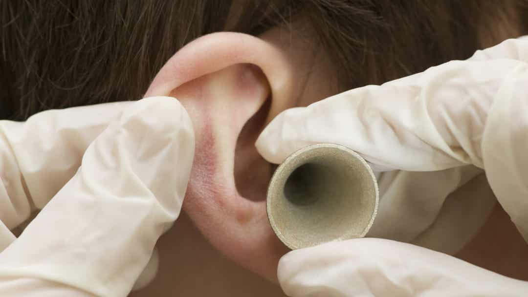 Otosklerose: Ursachen und Behandlung - Besser Gesund Leben