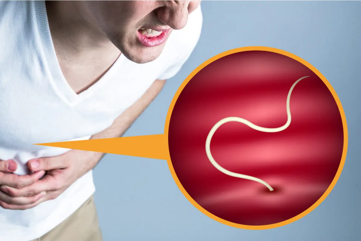 Parasitosis abdominal.