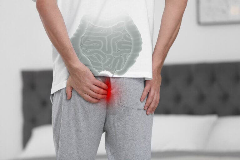 ¿Qué es el prolapso rectal y cuáles son sus causas?