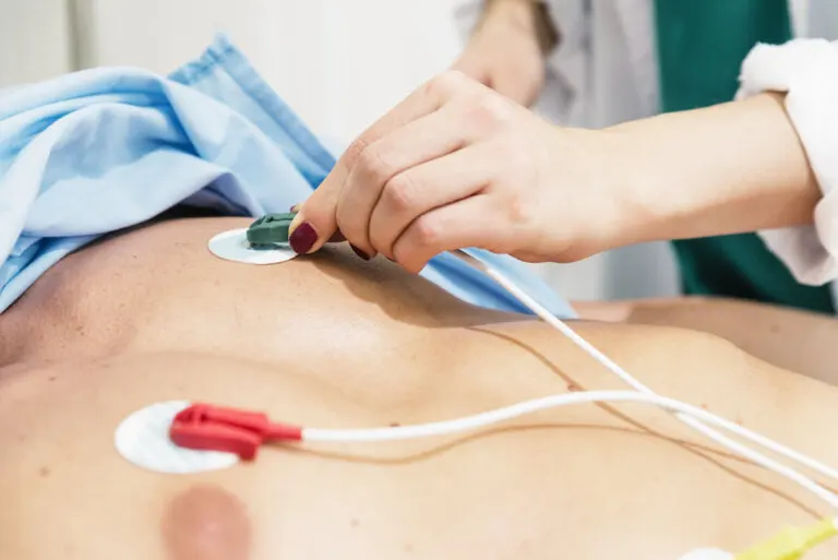 Todo lo que debes saber sobre el ECG