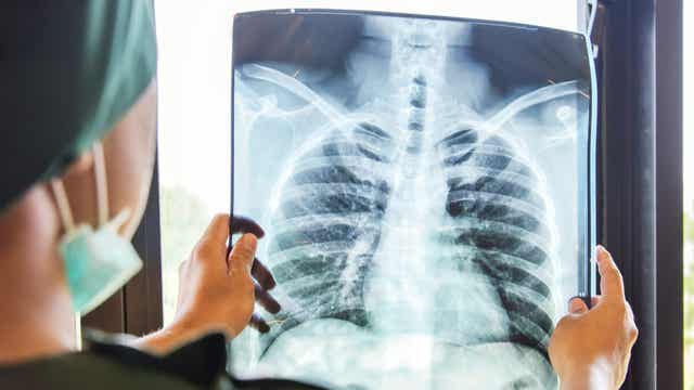 Tache dans les poumons : principales causes et traitement