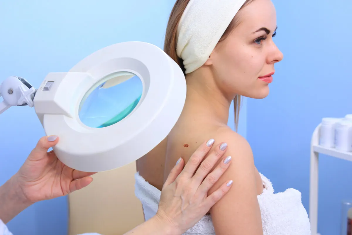 Revisación de piel en dermatología.