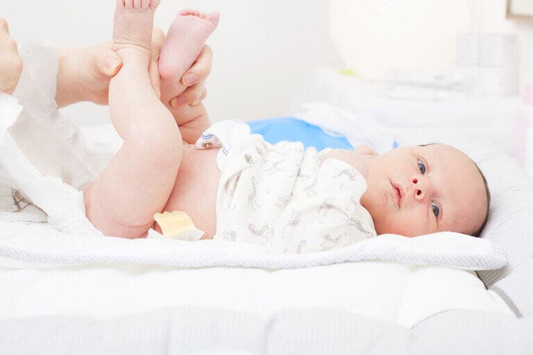 Dermatitis del pañal: síntomas, tipos y tratamiento