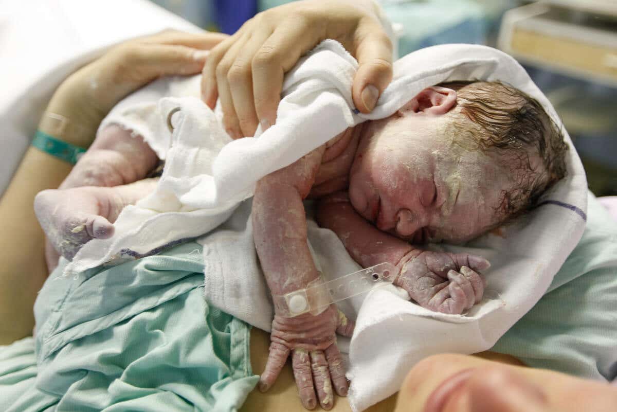 Vérnix caseosa en un recién nacido.