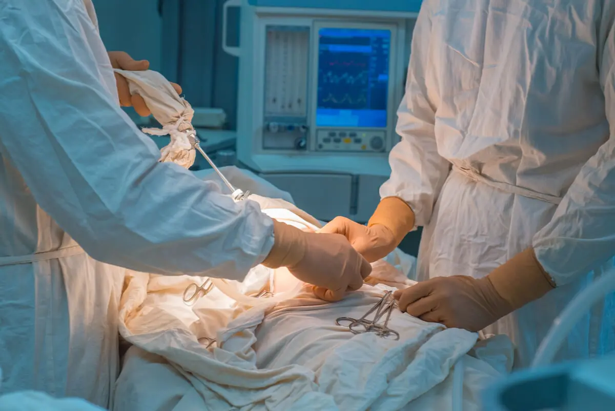 Chirurgie pédiatrique de l'hydrocèle.