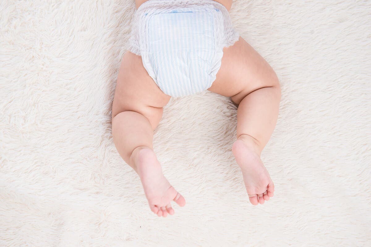 ¿Es posible prevenir la dermatitis del pañal?