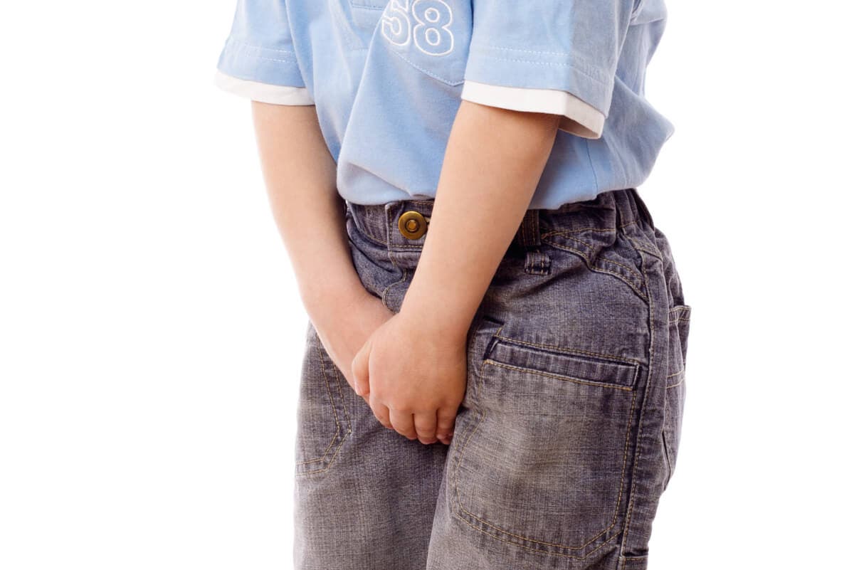 Balanitis con dolor en infante.