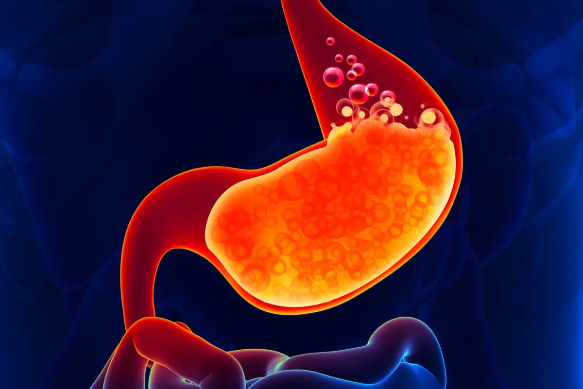 Acid reflux in the stomach.