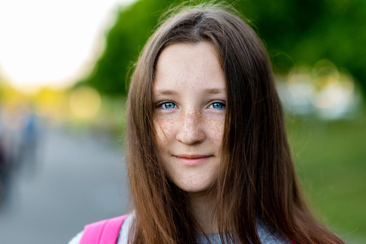 Adolescente con pecas.