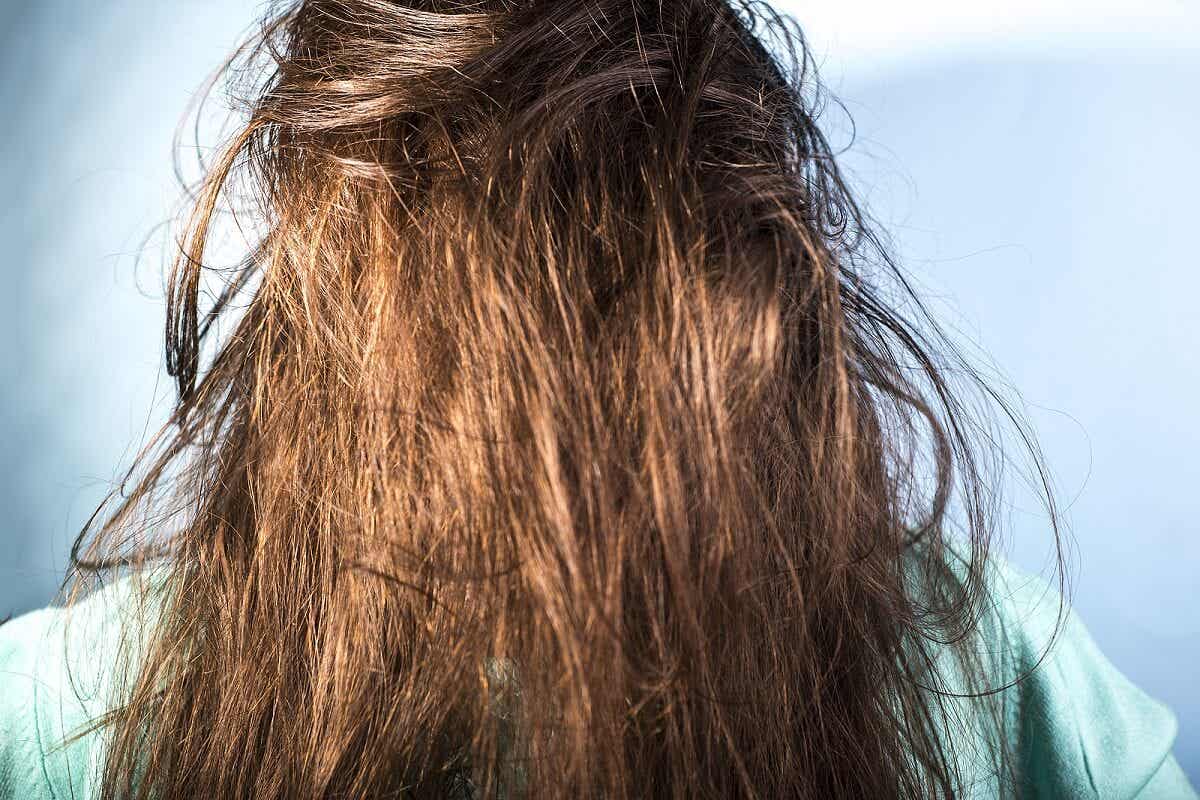 ¿Cuáles son las causas del cabello graso?