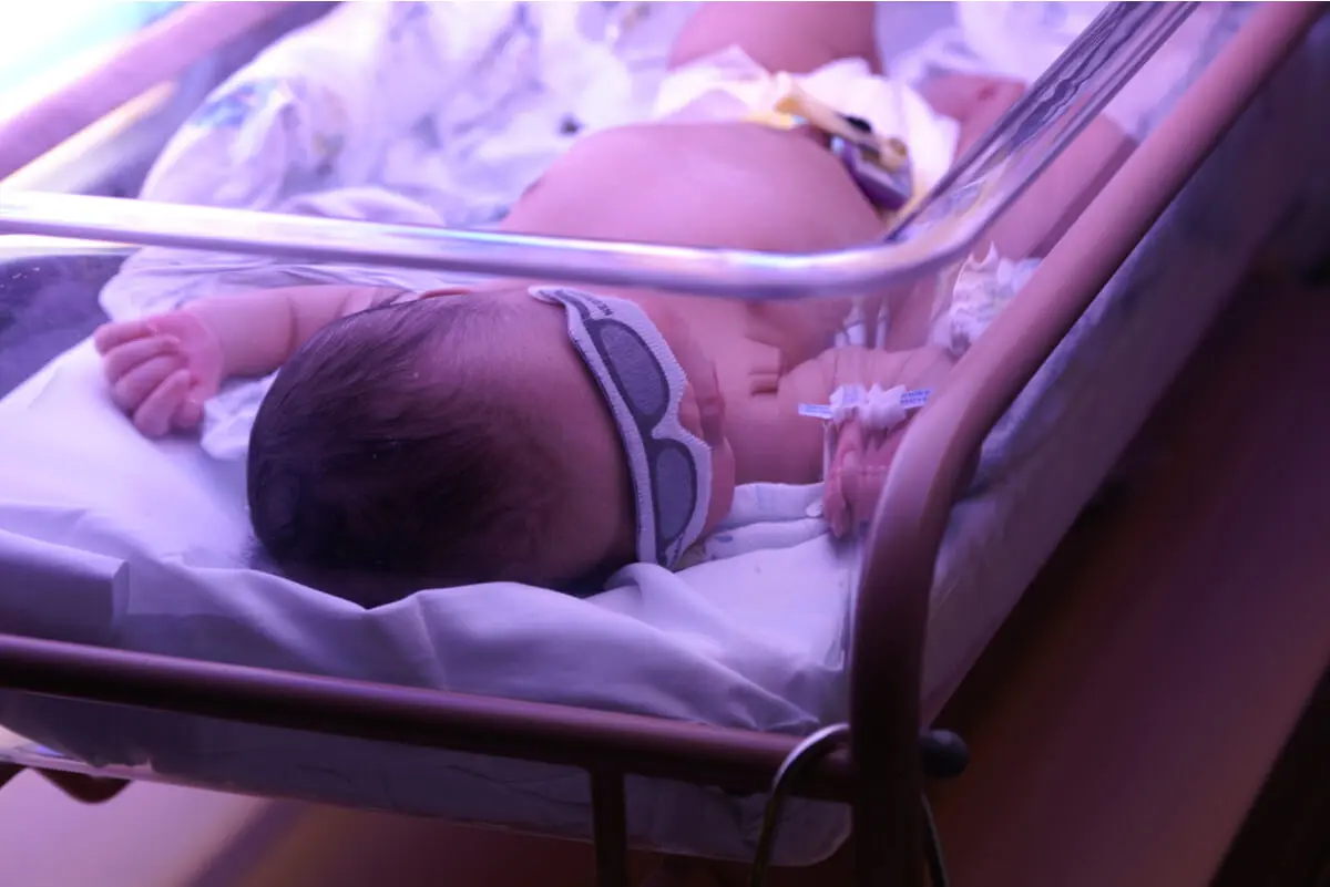 Tratamento neonatal da icterícia.