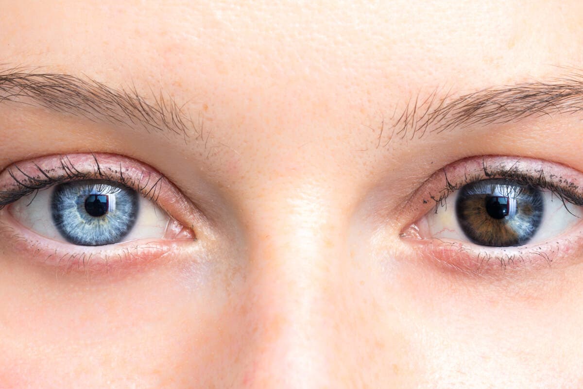 Lentes de contacto cosméticos.
