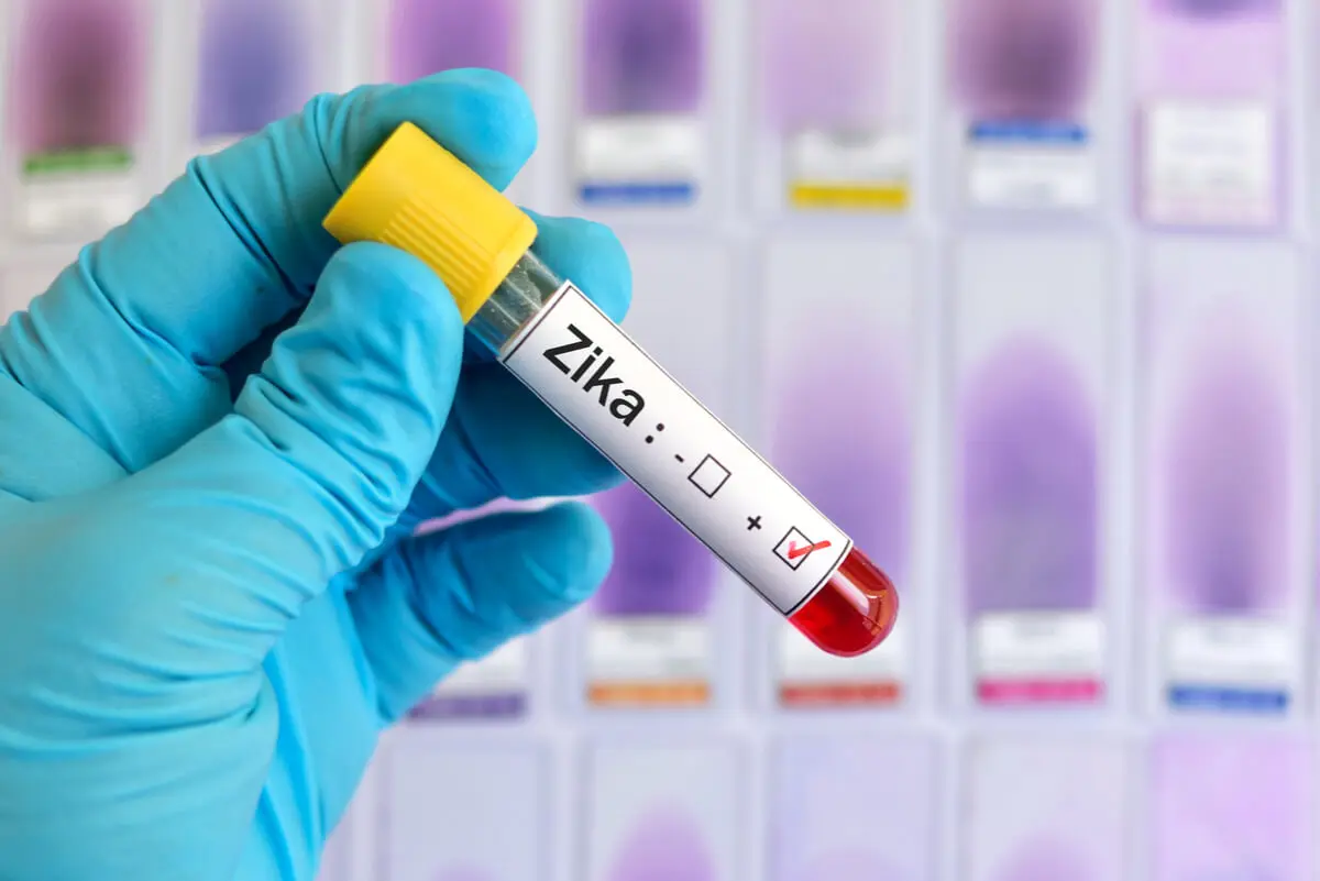 Test para virus zika.