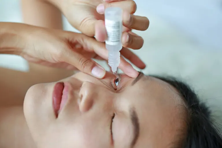 ¿Cómo me aplico correctamente las gotas en los ojos?