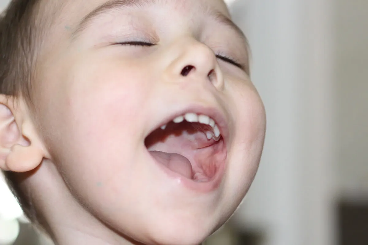 Niño con la boca abierta.
