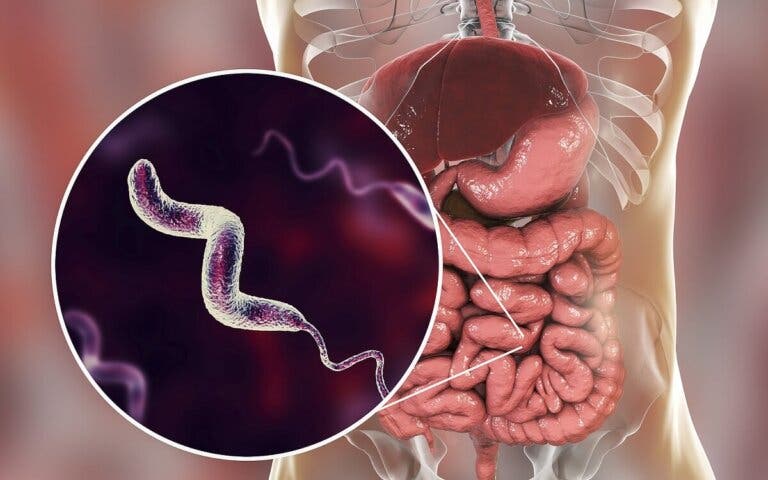 Infecciones por campylobacter: lo que debes saber