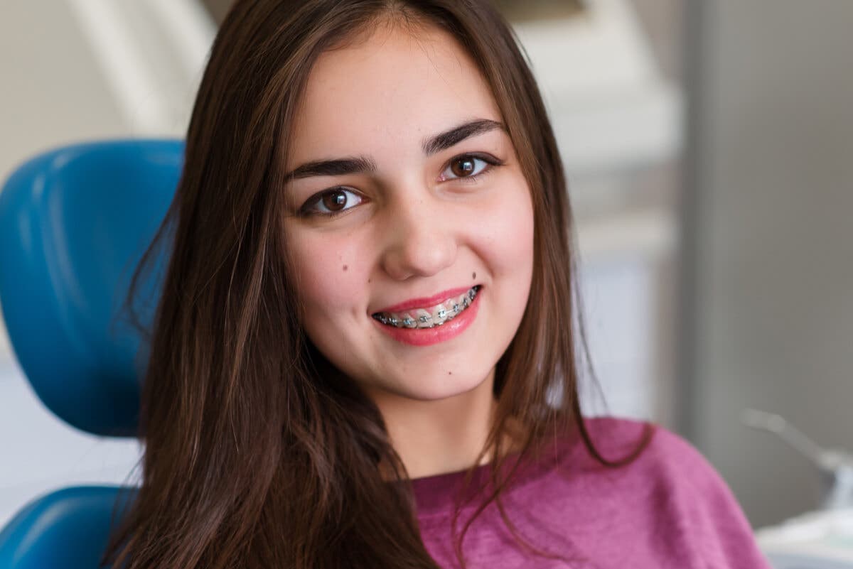 Appareil dentaire chez un adolescent.