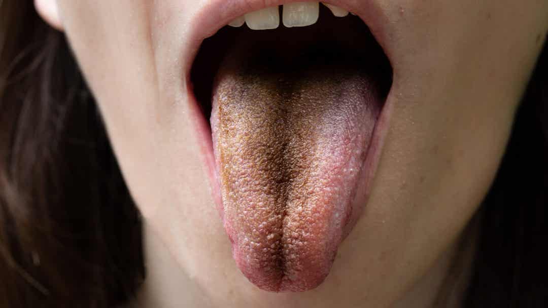 C mo Limpiar La Lengua Mejor Con Salud c-mo-limpiar-la-lengua-mejor-con-salud