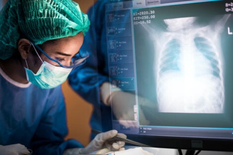 La lesión pulmonar asociada al vapeo puede ocurrir.