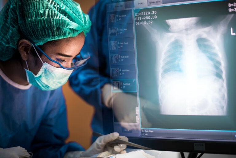 Trasplante de pulmón: todo lo que debes saber