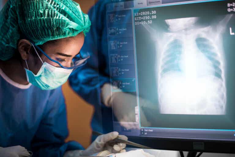 Trasplante de pulmón: todo lo que debes saber