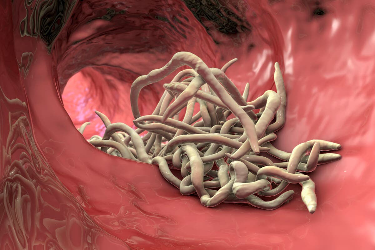 Ascaris en el intestino.