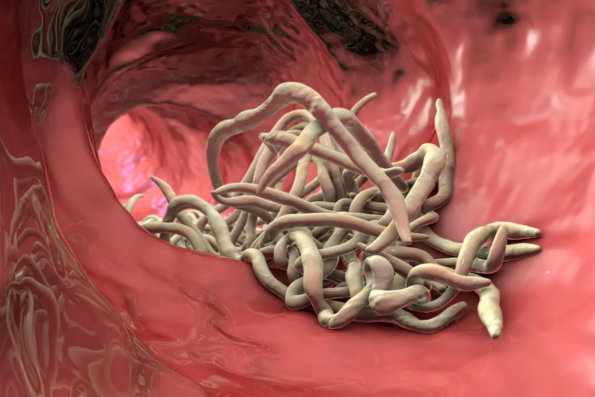 Ascaris en el intestino.