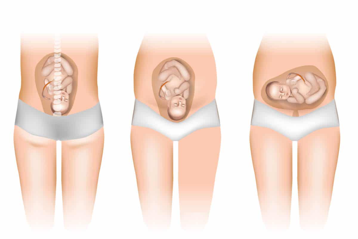 Esquema de las posiciones fetales durante el embarazo.