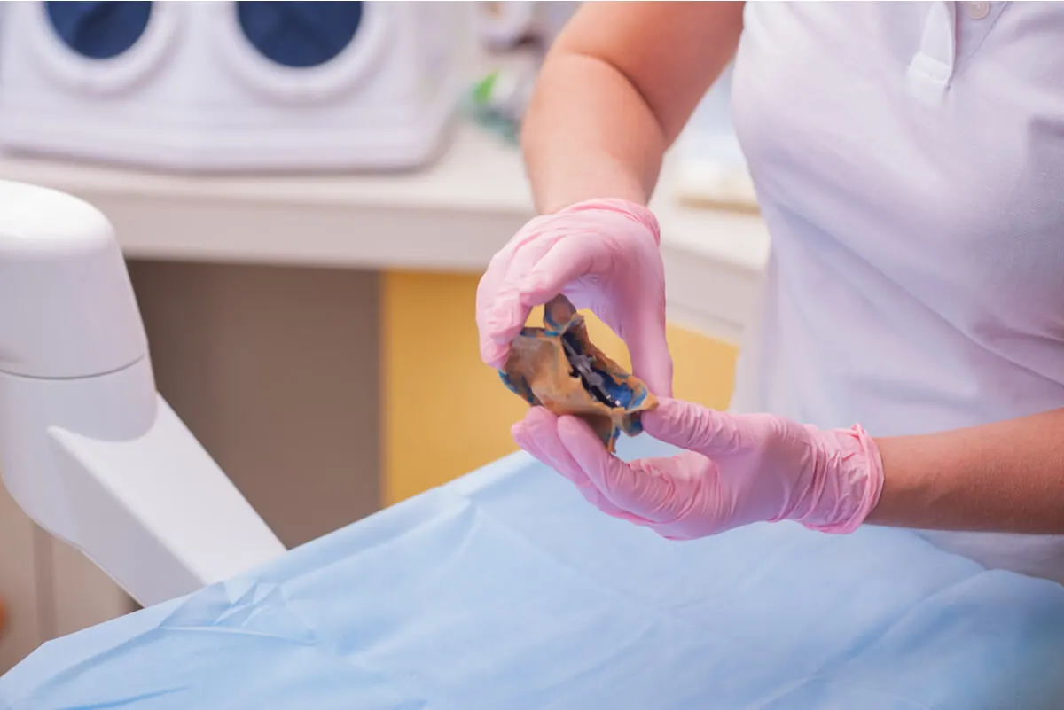 Prótesis dental genera bulto en el paladar.