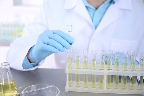 Urocultivo: ¿qué es y para qué se utiliza?