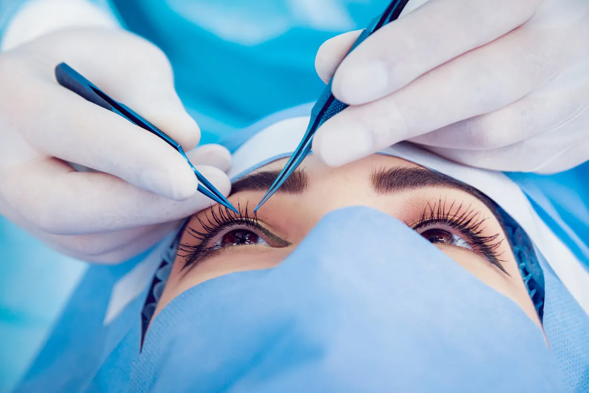 Cirugía ocular de blefaroplastia.