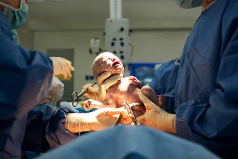 11 motivos para realizar un parto por cesárea