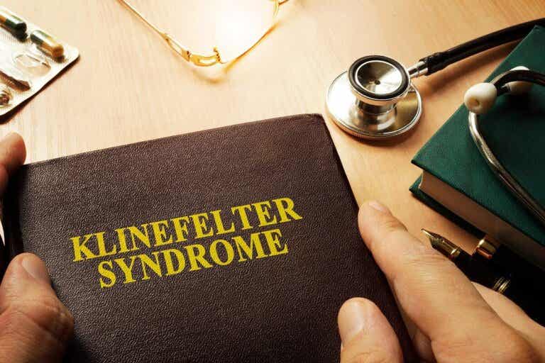 ¿Qué es el síndrome de Klinefelter y cómo afecta a los hombres?