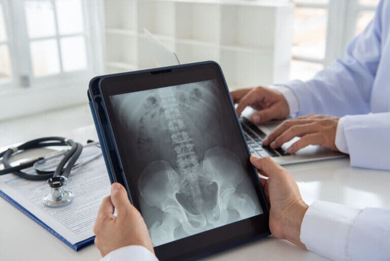 Tipos de pelvis y su relación en el parto