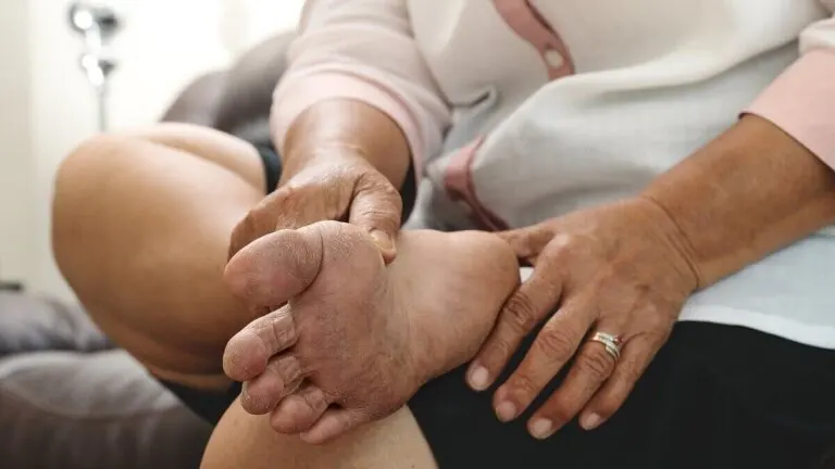 30 señales de diabetes que se manifiestan en la piel