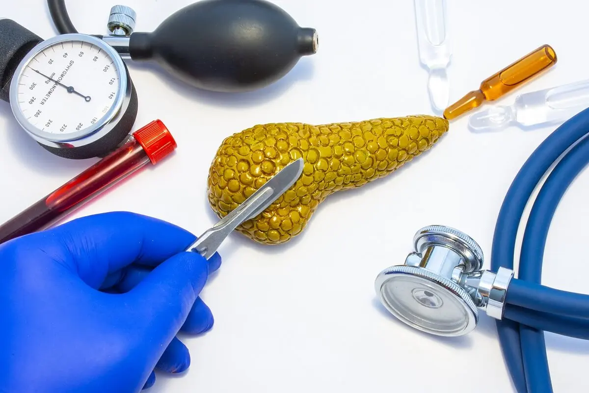 A pancreas.