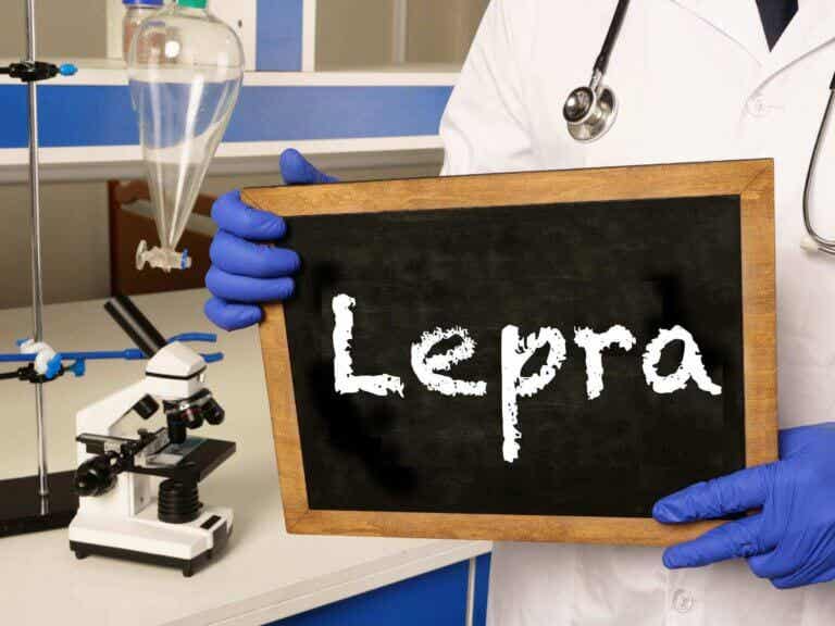 Día Mundial contra la Lepra: ¿qué debes saber de esta enfermedad?