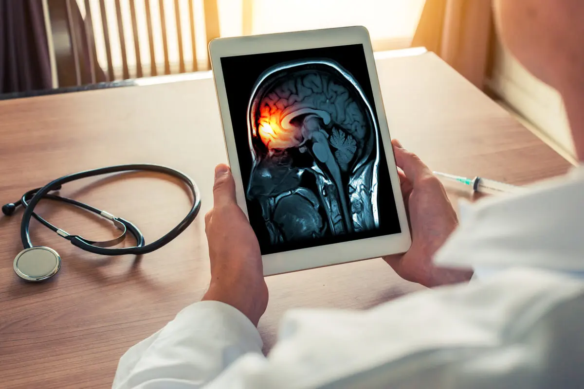 Arzt untersucht Flimmerskotom nach Hirninfrakt des Patienten